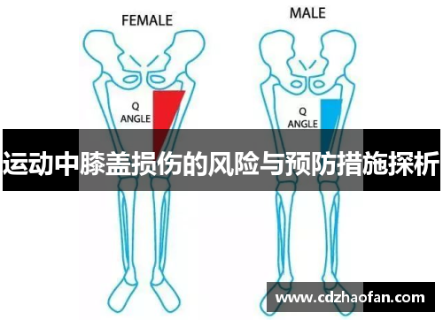 运动中膝盖损伤的风险与预防措施探析